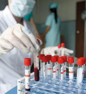 德国医疗研究人员发现清除艾滋病病毒的新方法