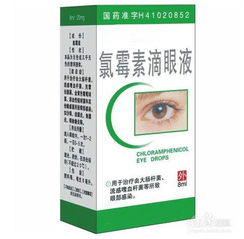 治疗麦粒肿的三个常用处方