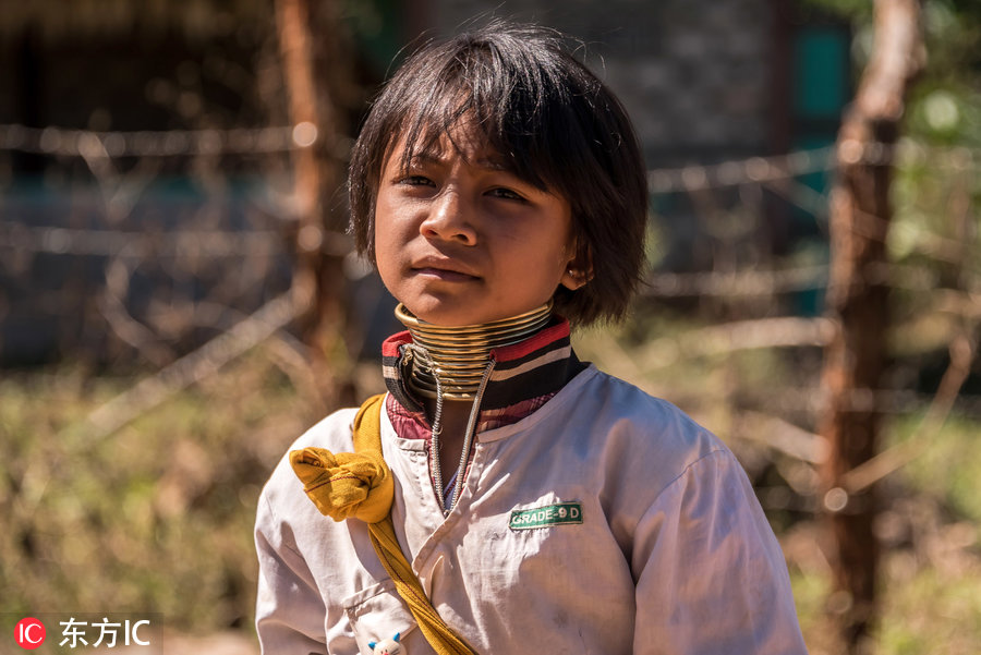 缅甸长颈族女子：为吸引异性忍受畸形残酷之美