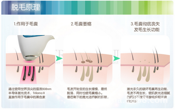 永久脱毛对身体有害吗 对皮肤有哪些副作用