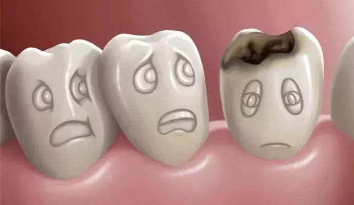 这样的治疗蛀牙小妙招，你get到了吗？
