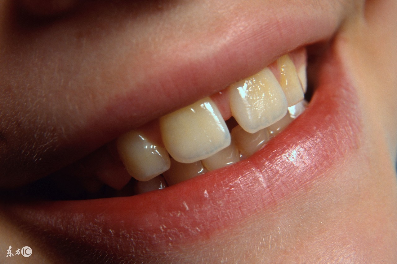 超声波洁牙的原理会不会伤牙？这回全部告诉你！