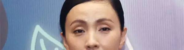 眼窝深不是欧美风，那是胶原蛋白流失！