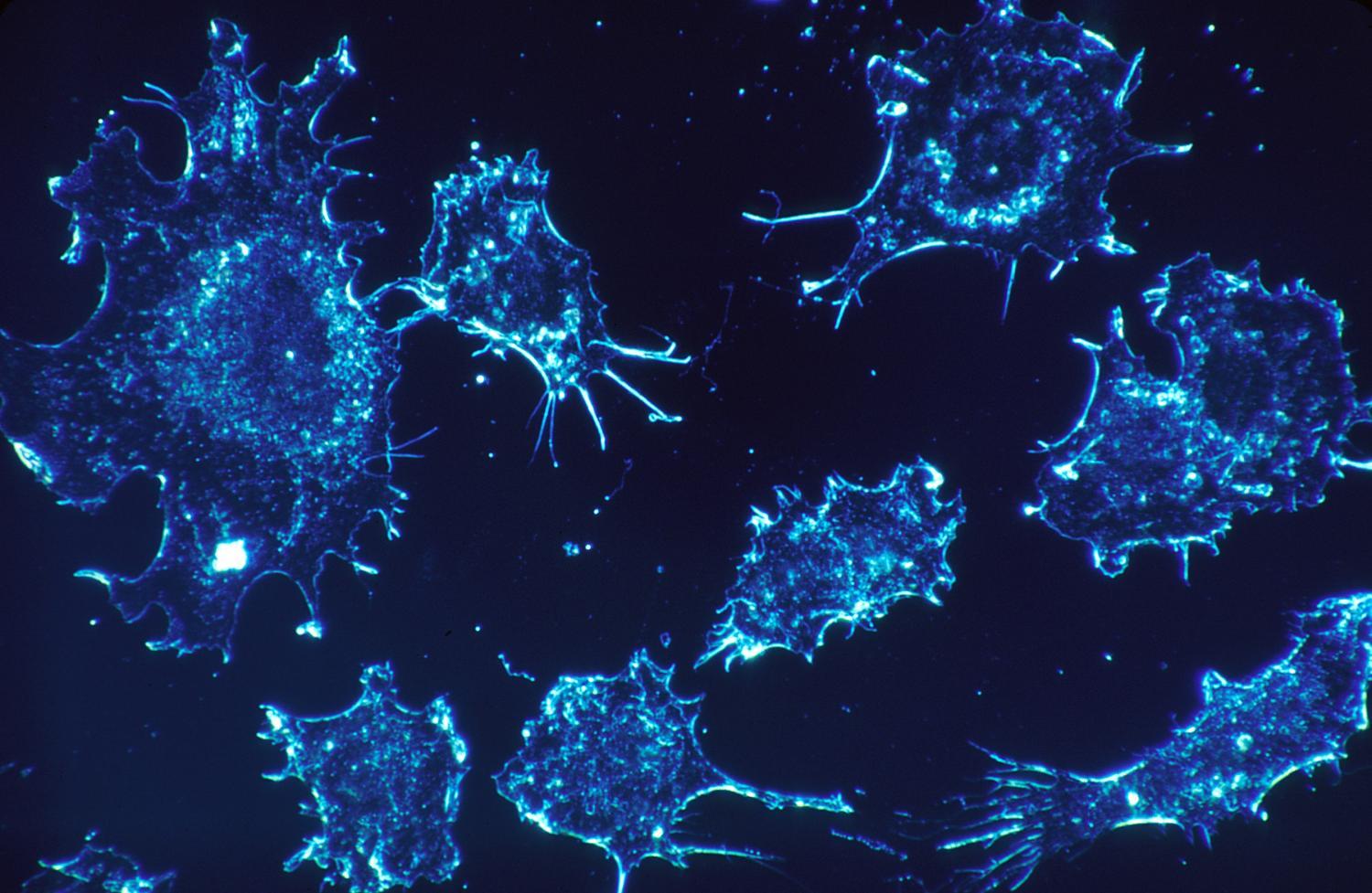 新免疫疗法提高了身体摧毁癌细胞的能力