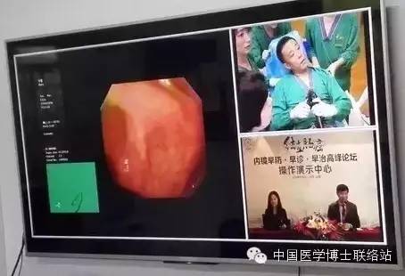 真牛！上海医生自己给自己做肠镜，现场直播！