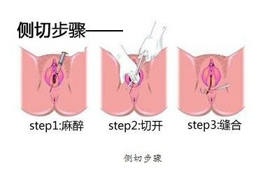 处nu膜是怎样才算破了（没进入就外面摩擦是不会怀孕的）