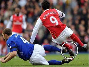 足球腿断照片足球断腿视频集锦