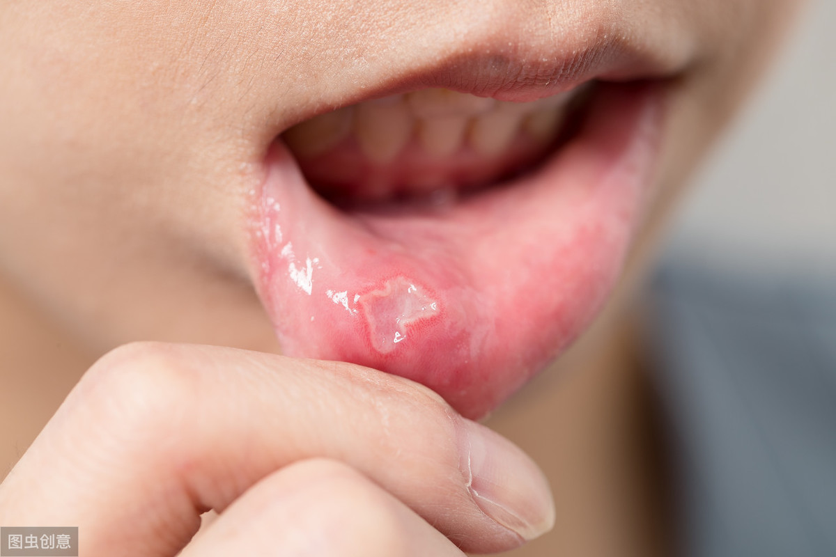 当肝功能异常时，嘴巴常有5个症状！若你一个没占，说明肝脏很健康