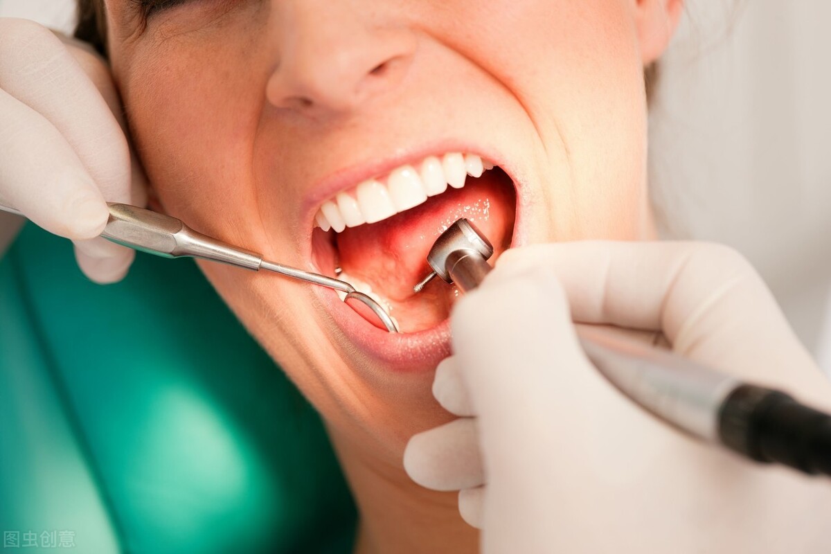 牙坚决不能拔？洗牙牙缝会变大？关于牙齿的几个谣言，你信过几个