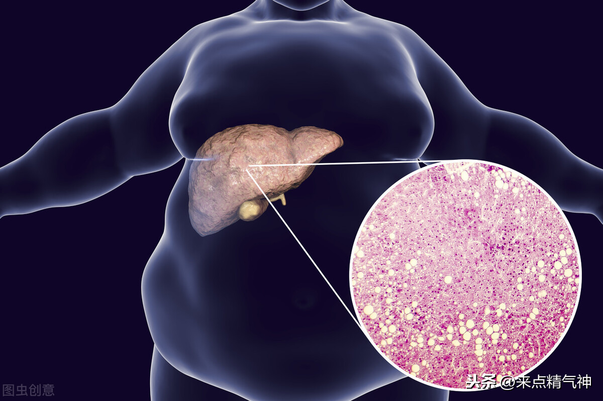 肝臟就是“油煙機”！ 油污太多導致脂肪肝，穴位“揉”回去