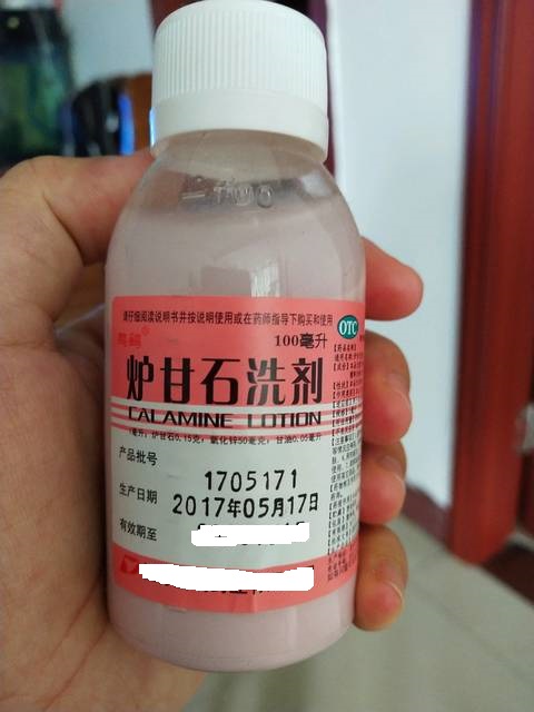 宝宝湿疹用什么药膏好常用于婴幼儿湿疹的五类药物