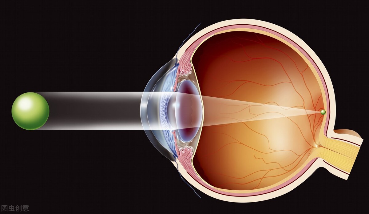 Why does diabetes cause blurred vision, decreased vision, and even