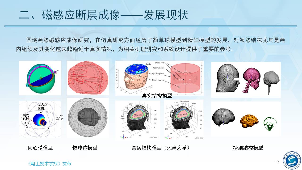 沈陽工業(yè)大學(xué)柯麗教授：感應(yīng)式顱腦電磁特性檢測與成像方法研究