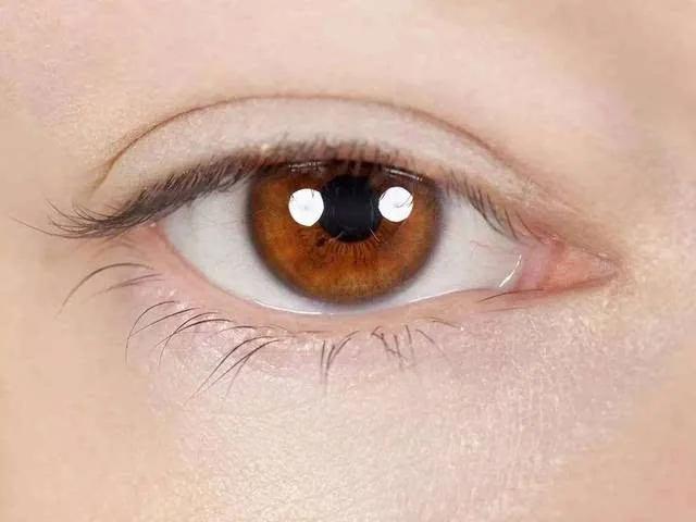 熱雞蛋敷眼睛要注意哪些方面? 都有什麼好處呢?