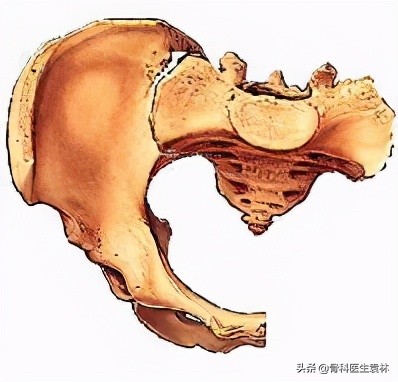 骶髂關節紊亂是什麼意思骶髂關節紊亂為什麼會導致膝蓋疼