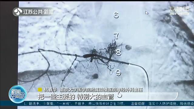 走着走着双腿发软 17岁少女险瘫痪 提醒：这种情况72小时内尽快就医