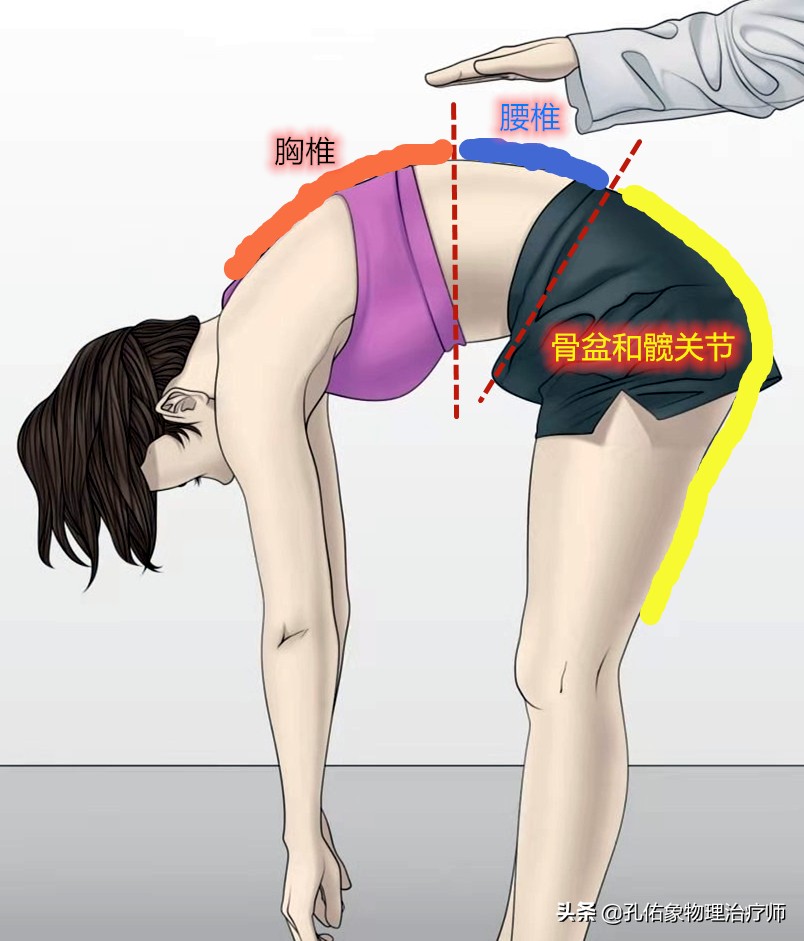 Why not only can I not bend down, but my back hurts when I bend? The