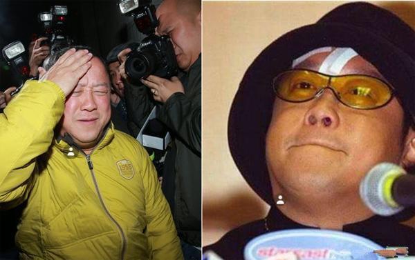 曾志伟在台前乱说话，一顿暴打缝了几十针，幕