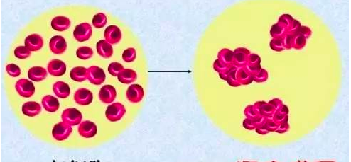 最罕見血型2017年在江蘇出現，全球僅此一例，已被國際基因庫收錄