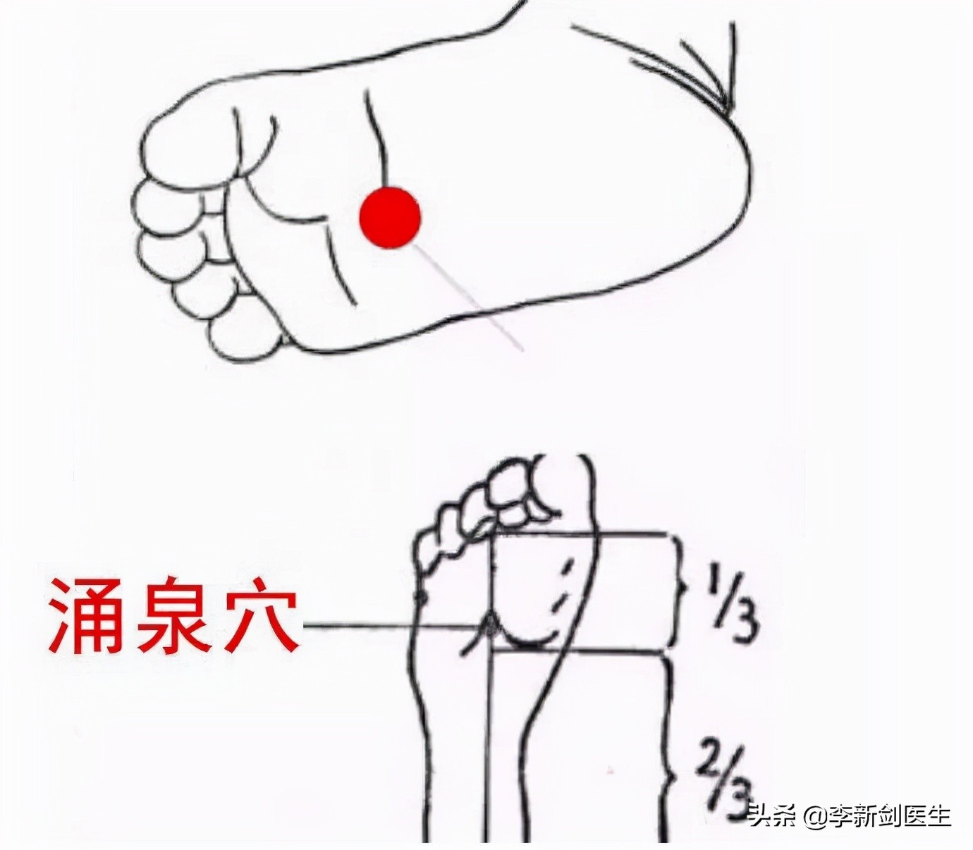 Three Points Of The Kidney Channel Of Foot Shaoyin Inews
