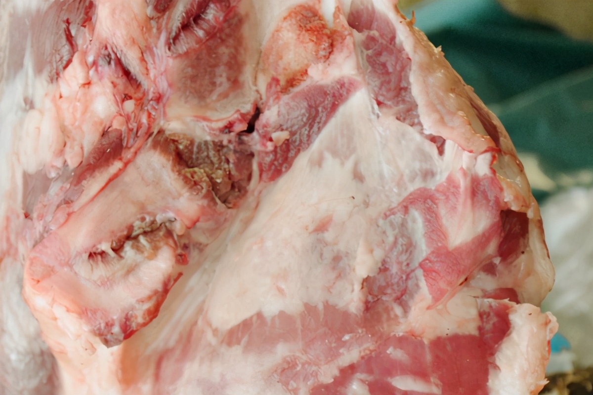 膽固醇高的人，雞蛋、瘦豬肉、牛奶，可以吃哪個？ 醫生告訴你