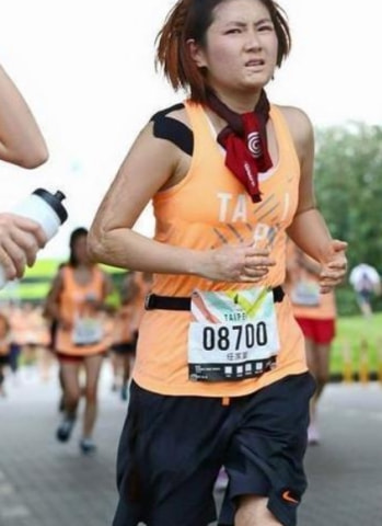 烧伤后被“暖男”抛弃，张承中直言看到Selina烧伤腿部：真的想吐