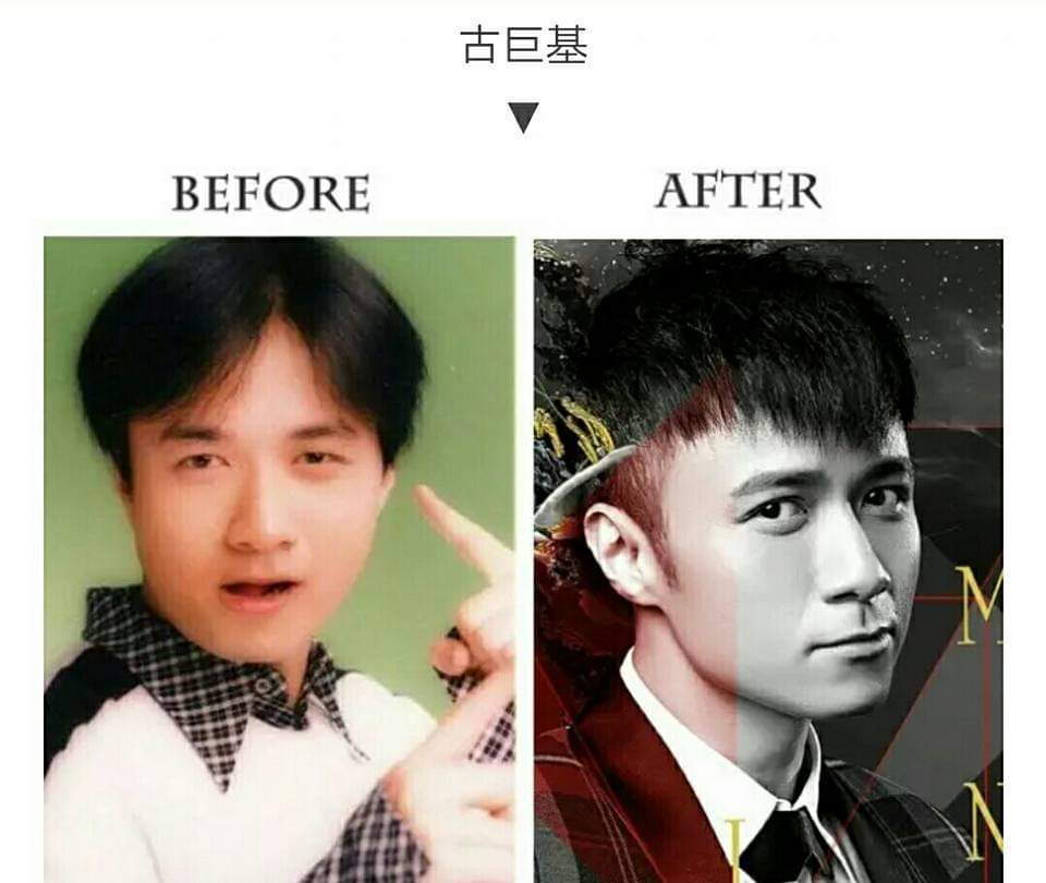 女看眼 男看鼻 塌鼻梁的男生如何改善 头条汇