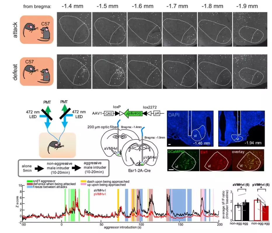 微小腦區的精確再細分