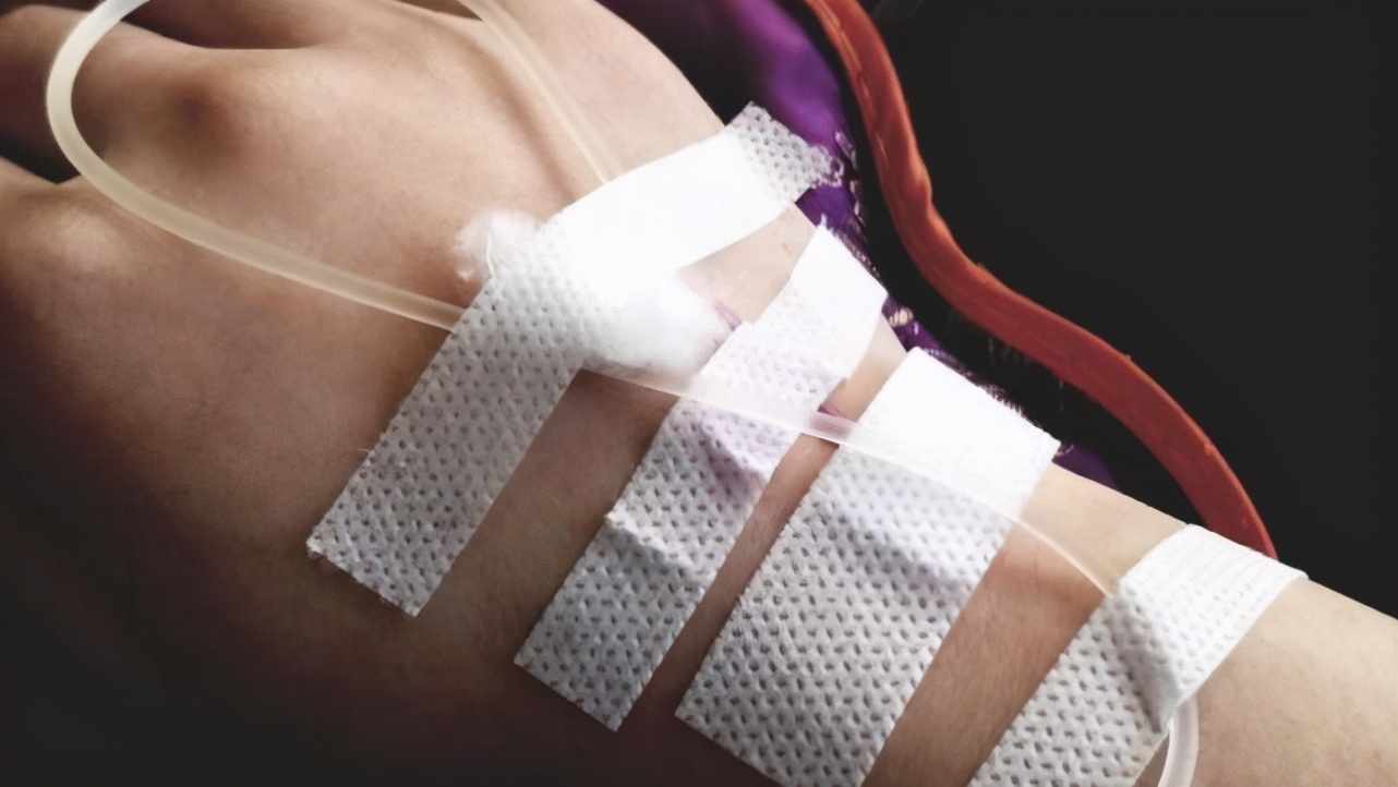 在冬季，老年人輸液真的可以疏通血管嗎？