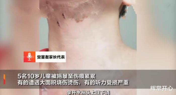 河北5名10岁儿童遭2名15岁少年疯狂施暴，开水从头向下浇，令人发指！