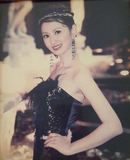脸僵如石！明知“硅胶脸”恐怖，为何还有女星