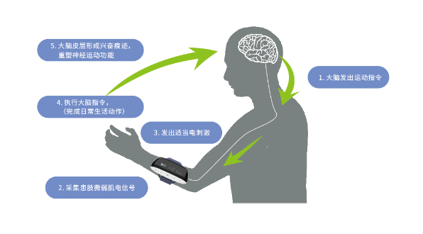 讯丰通：手功能康复治疗仪定制个性化治疗方案