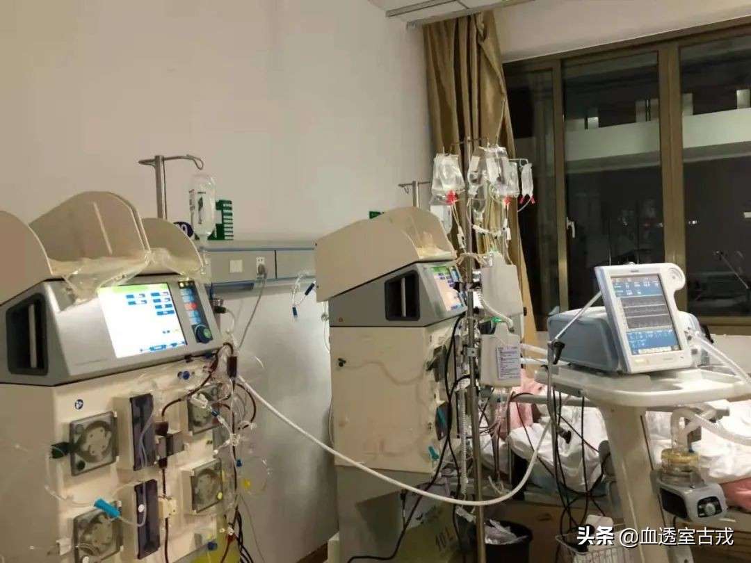 CRRT治疗中，分段枸橼酸钠体外抗凝效果如何？怎么用？
