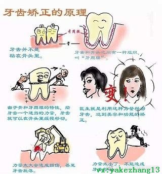 牙齿矫正的需要多长时间？