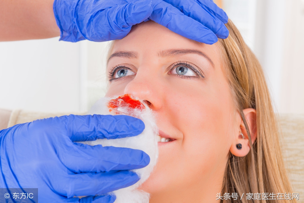 流鼻血时，采用这9个方式，能帮助快速止血