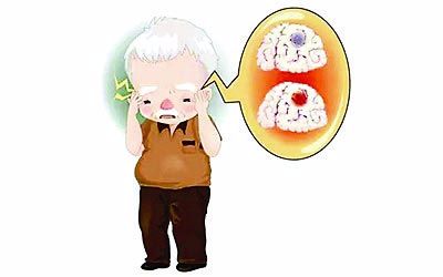 哪些疾病可能与脑梗有关？如何预防？