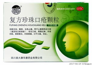 治疗口疮的中成药有哪些？