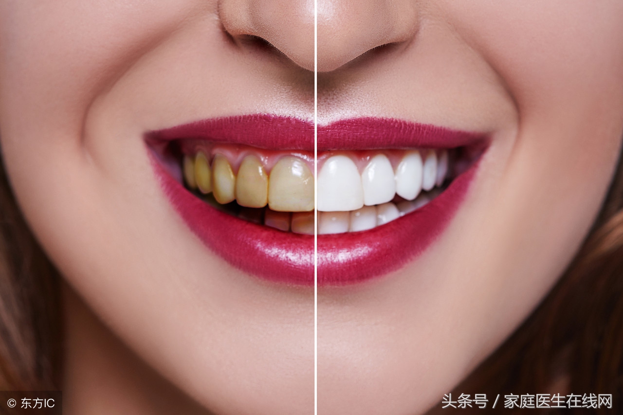 人的牙齿为什么会变黄？估计是没做好这6件小事