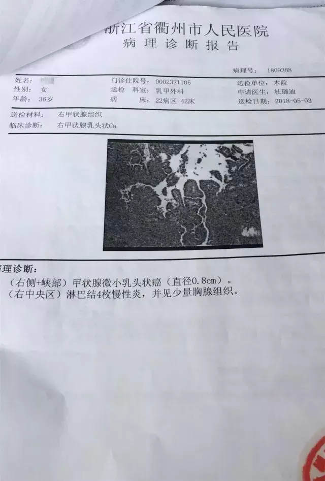 真实理赔案例:XX人寿,这样的拒赔理由我不能接受,法庭见! 第4张 真实理赔案例:XX人寿,这样的拒赔理由我不能接受,法庭见! 第4张