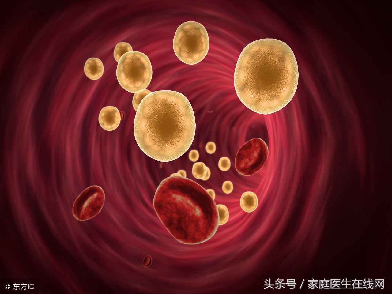 高血脂怎么降血脂？不要太复杂：把这4件小事干到位