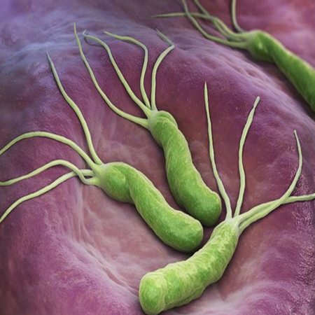 幽门螺旋杆菌需要治疗吗，它主要有哪些治疗方法呢？