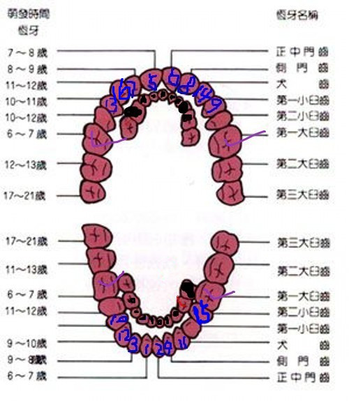 学会区分乳牙和恒牙，千万别拔错恒牙