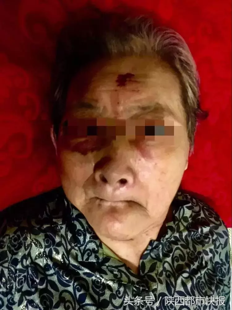 令人发指!儿女花5000元请保姆照顾86岁老母亲,老人竟被殴打骨折