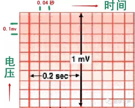 心电监护仪怎么看？教你如何看心电图！