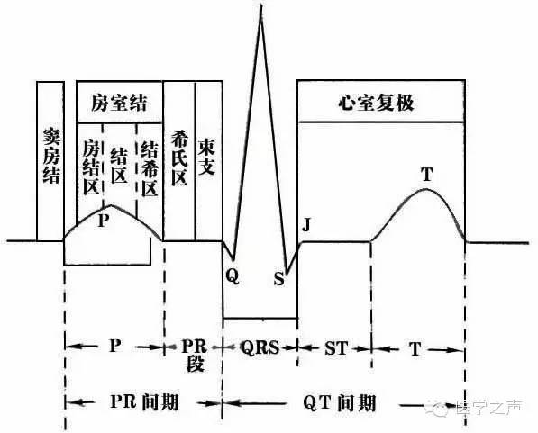 这么教你看心电图，还有什么理由看不懂？