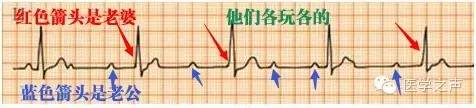 心电监护仪怎么看？教你如何看心电图！