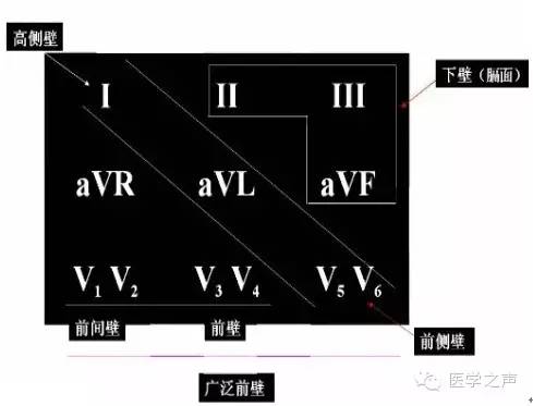 这么教你看心电图，还有什么理由看不懂？