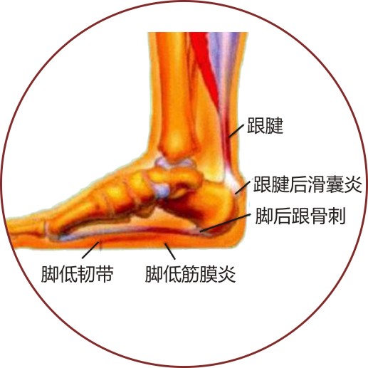 我和妈妈说 跟骨刺是这样的 其他 蛋蛋赞