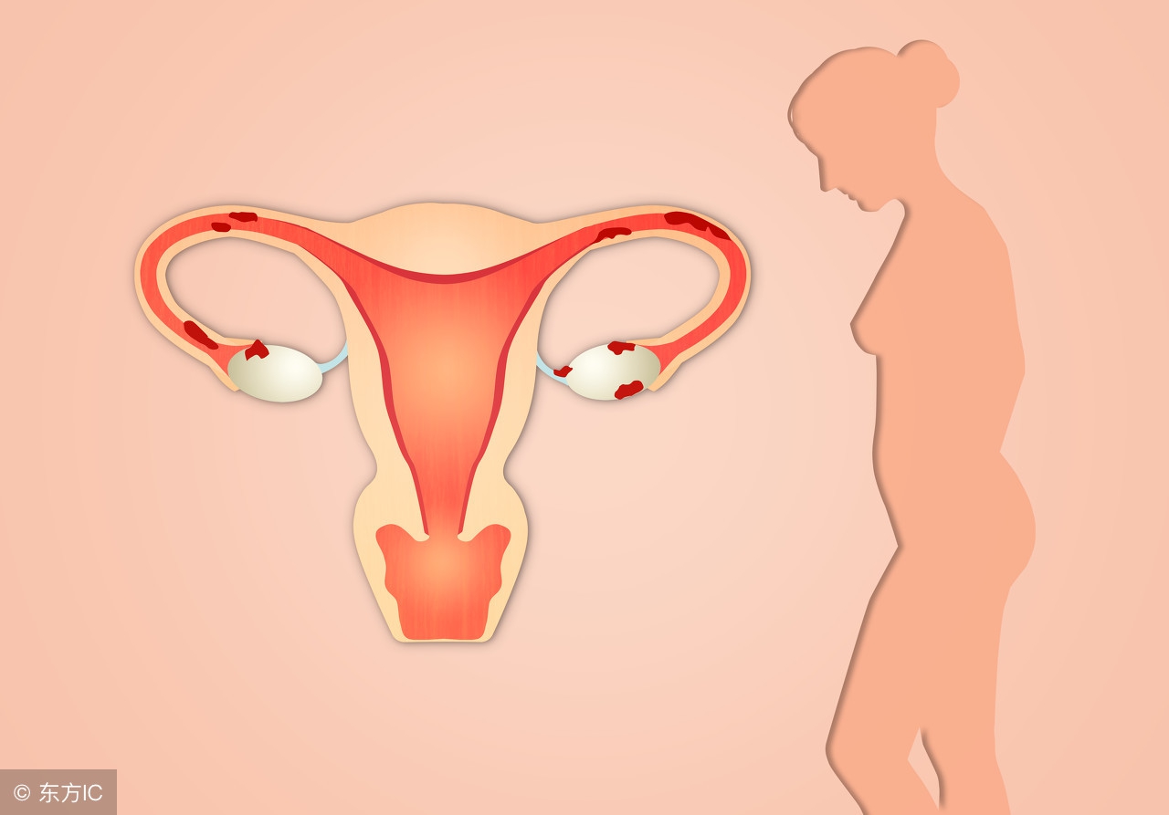 导致宫外孕的原因有哪些？祸根可能是这2个，不容小觑