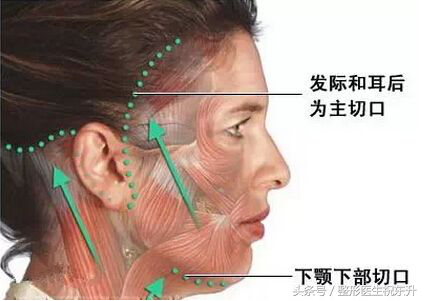 60多岁想做面部提升，适合哪种方法？拉皮手术怎样？